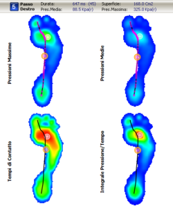 baropodometria-torino